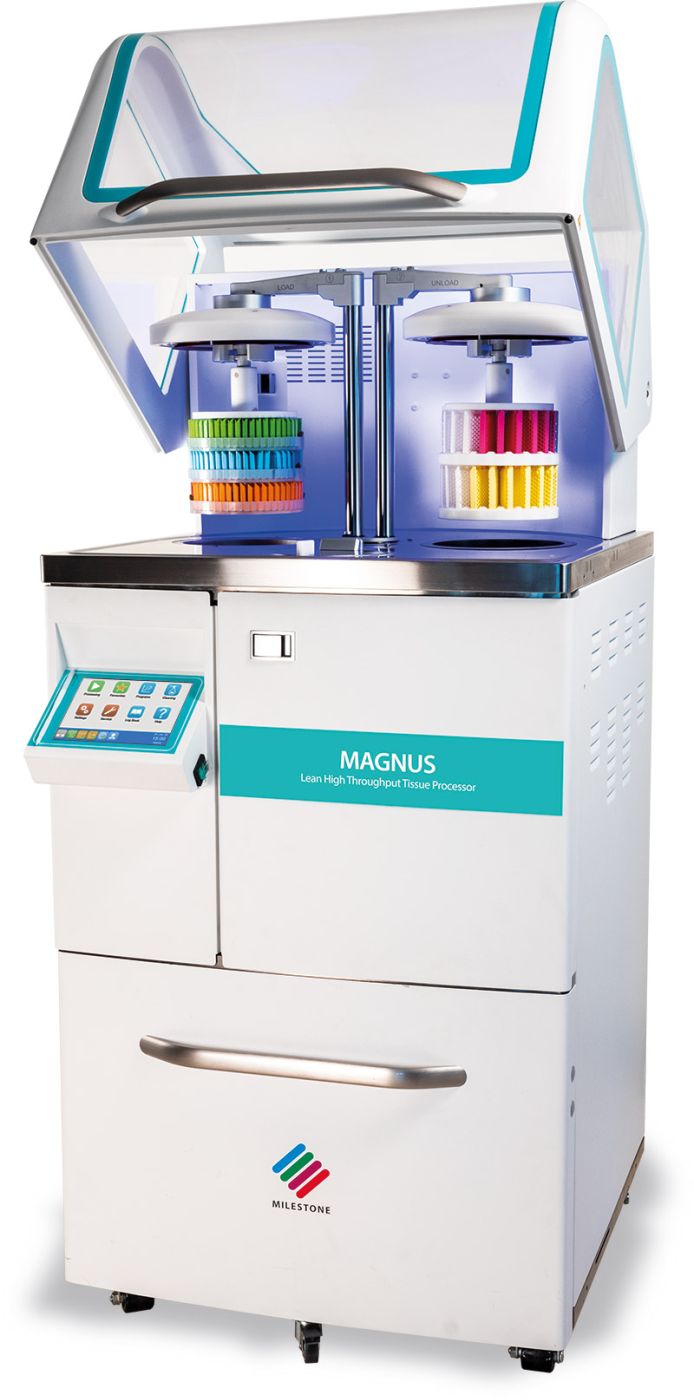 MAGNUS